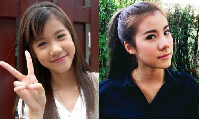 เอสเธอร์ สวย (ดั้ง) พุ่ง ยืดอกรับ ทำศัลยกรรมรอบ 2