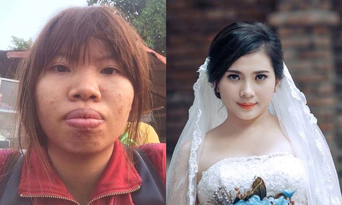 อึ้งทั้งงาน! สาวศัลยกรรมเปลี่ยนตัวเอง เซอร์ไพรส์แฟนในวันแต่งงาน