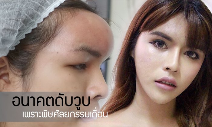 เน็ตไอดอลสาวประเภทสอง อนาคตดับวูบ เพราะพิษศัลยกรรมเถื่อน