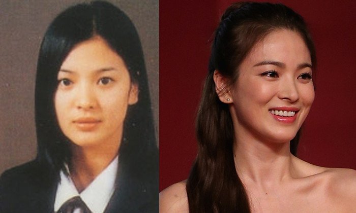 35 ยังหน้าเด็ก! ส่องความสวย ซงฮเยคโย ว่าที่เจ้าสาวซงจุงกิ สวยจริงหรือศัลยกรรม?
