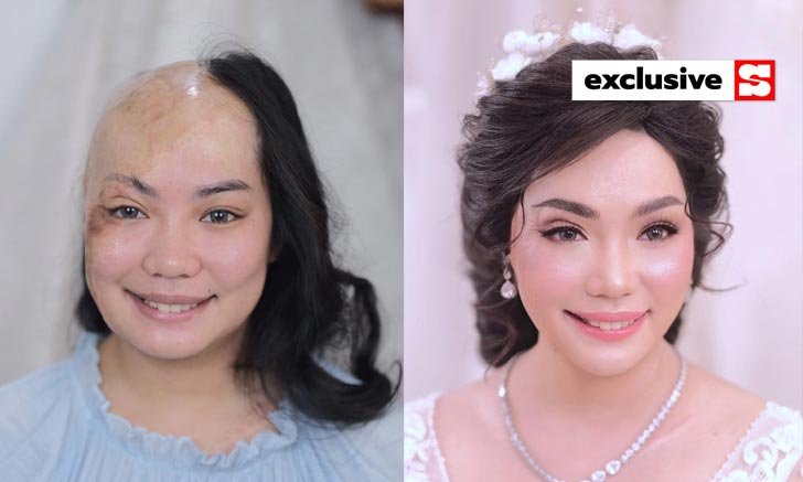 ครั้งหนึ่งในชีวิต! แต่งหน้า ทำผม เจ้าสาวแก้ไขปัญหาจากอุบัติเหตุ สวยหวานมาก