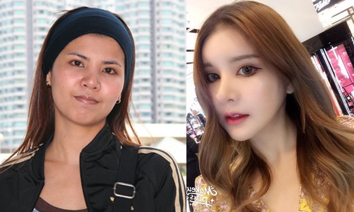 สวยยันกระดูก! สาวไทยทุ่มเงินกว่า 6 ล้าน เปลี่ยนเบ้าหน้าเป็นคนละคน