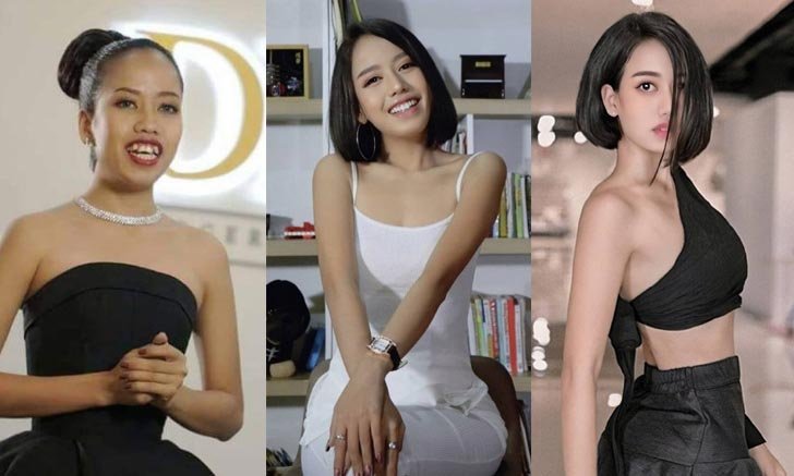 "ตุ๊ก เดอะว้าวลาว" หลังจัดฟัน งามหลาย ลืมลุคเดิมไปเลย
