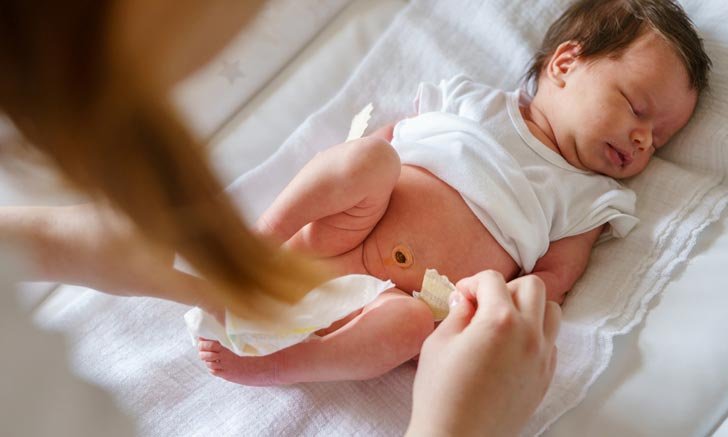พ่อแม่มือใหม่ควรรู้! วิธีดูแลสะดือของทารกแรกเกิดให้สะอาดอยู่เสมอ