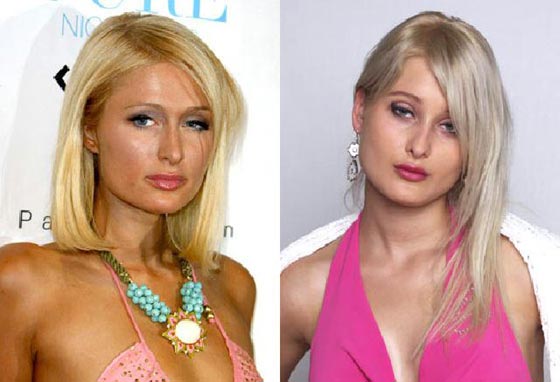 ปารีส ฮิลตัน VS แอนนา นิโคลาเยฟนา