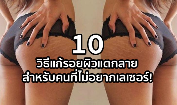 10 วิธีแก้รอยผิวแตกลาย สำหรับคนที่ไม่อยากเลเซอร์!