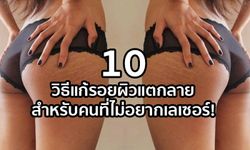 10 วิธีแก้รอยผิวแตกลาย สำหรับคนที่ไม่อยากเลเซอร์!