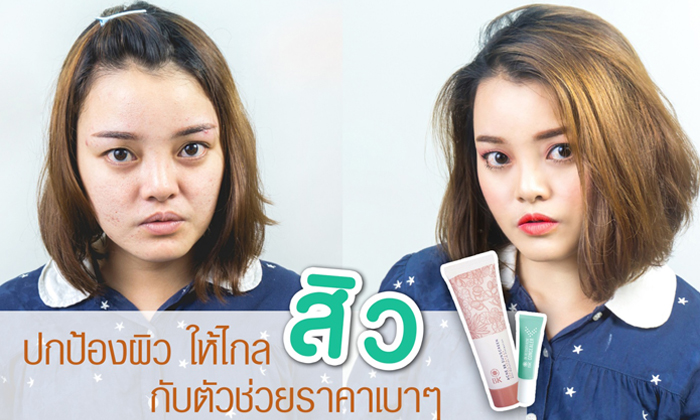 ปกป้องผิว ให้ไกลสิว...กับตัวช่วยราคาเบาๆ