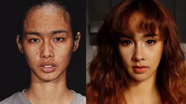 เปลี่ยนลุค ป่าน สาววัย 21 ฟันไม่ปกติ เป็นนางแบบหน้าเกาหลี