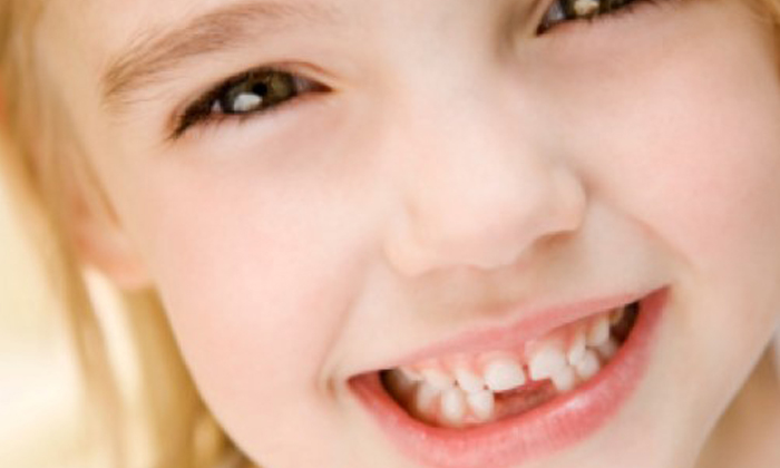 ระวัง “ฟันผุ” เรื่องเล็กที่หลายคนมองข้าม อาจเสี่ยงโรคร้ายอย่างคาดไม่ถึง