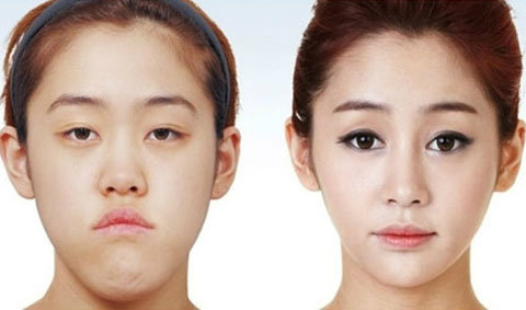 ก่อน-หลัง ศัลยกรรมเปลี่ยนชีวิตสาวเกาหลี