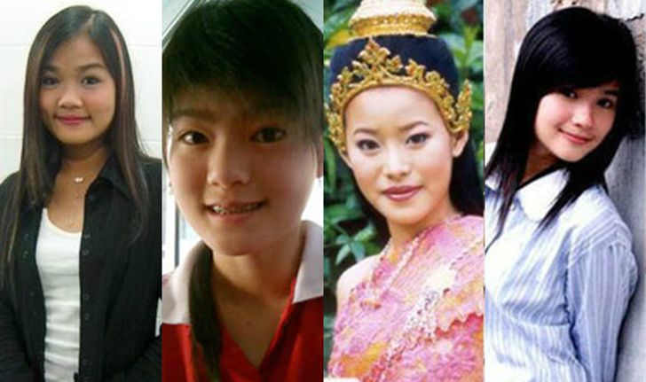 10 อันดับ ศัลยกรรมความงามน่าทึ่งที่สุดปี 2013