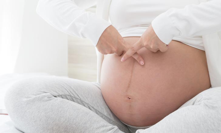 6 เรื่องต้องห้ามสำหรับคุณแม่ตั้งครรภ์