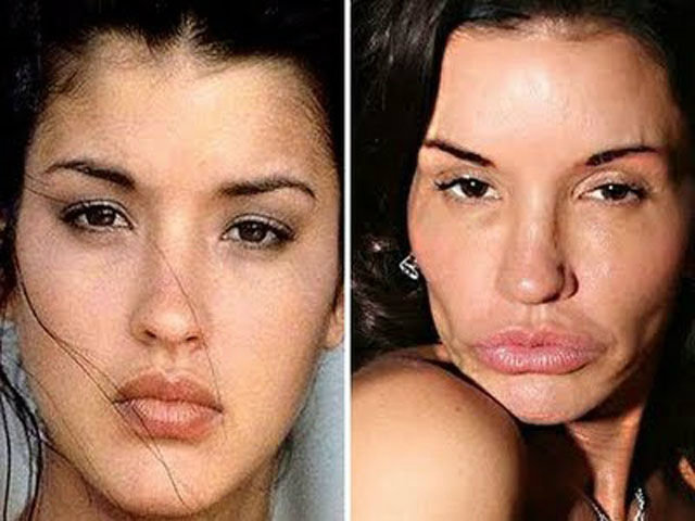 plastic surgery