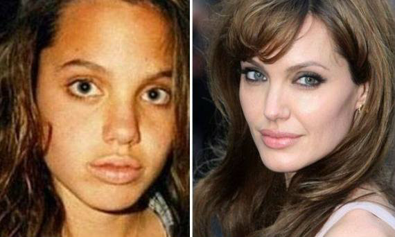 plastic surgery