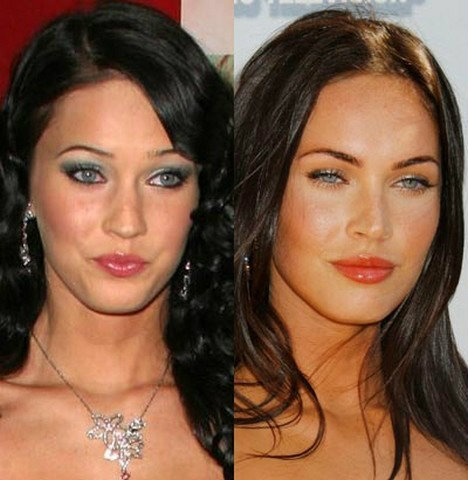 plastic surgery