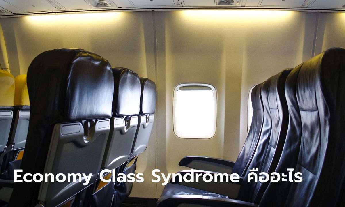 "Economy Class Syndrome" คืออะไร เกี่ยวกับการนั่งเครื่องบินชั้นประหยัดอย่างไร ทำไมอันตรายถึงชีวิต