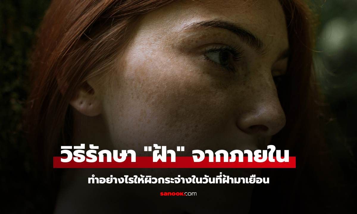 วิธีรักษา "ฝ้า" จากภายใน ทำอย่างไรให้ผิวกระจ่างในวันที่ฝ้ามาเยือน