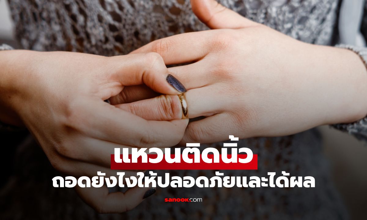 3 วิธี “ถอดแหวนติดนิ้ว” ออกอย่างปลอดภัยและได้ผล