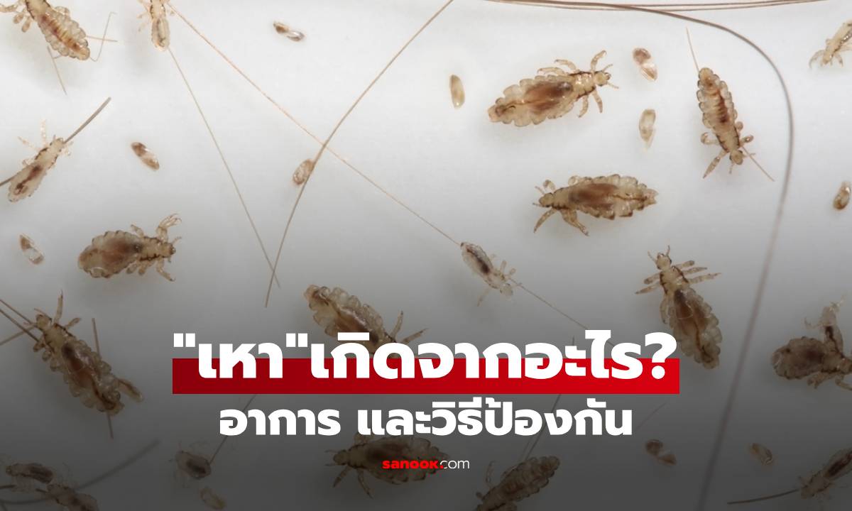 “เหา” ไม่ใช่เรื่องสกปรกอย่างที่คิด! เปิดสาเหตุแท้จริงและการแพร่ระบาดที่คุณอาจไม่เคยรู้