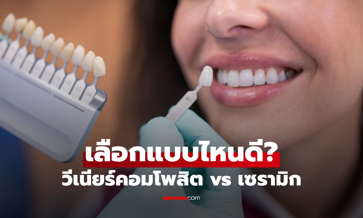 วีเนียร์คอมโพสิต vs เซรามิก เลือกแบบไหนดี ก่อนตัดสินใจทำ!