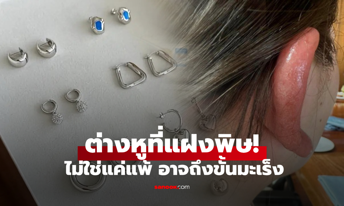 เตือน! "ต่างหู" ที่ขายดีในออนไลน์ เปิดประตูเชื้อโรคเข้าร่างกาย ไม่ใช่แค่แพ้ แต่อาจถึงขั้นมะเร็ง