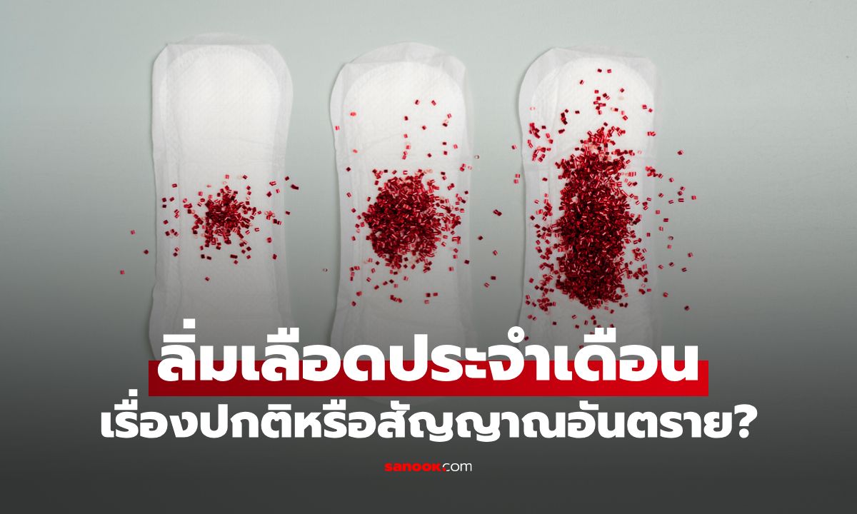 ลิ่มเลือดประจำเดือน เรื่องปกติหรือสัญญาณอันตราย?