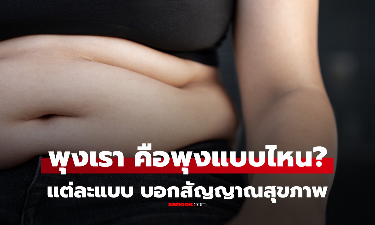 "พุง" มีกี่แบบ ส่องกระจกด่วน พุงของเราคือแบบไหน บ่งบอกสุขภาพ ไม่ใช่แค่อ้วน!
