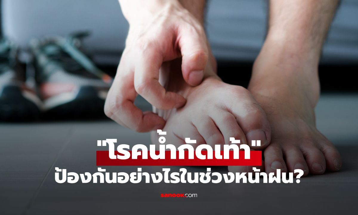 วิธีป้องกัน "โรคน้ำกัดเท้า" ภัยเงียบที่มาในช่วงหน้าฝน