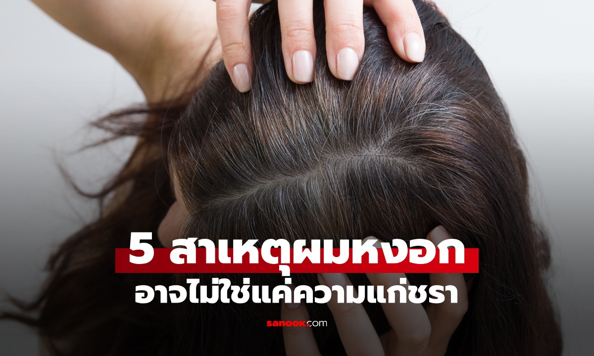 ผมหงอกก่อนวัยเกิดจากอะไร เช็ก 5 สาเหตุที่ทำให้ "ผมขาว" อาจไม่ใช่เพราะแก่