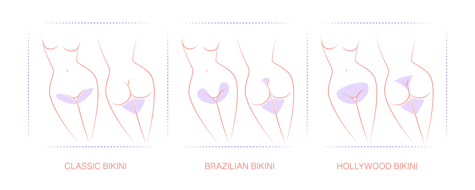 บราซิลเลี่ยน กับ บิกินี่แว็กซ์ ต่างกันยังไง