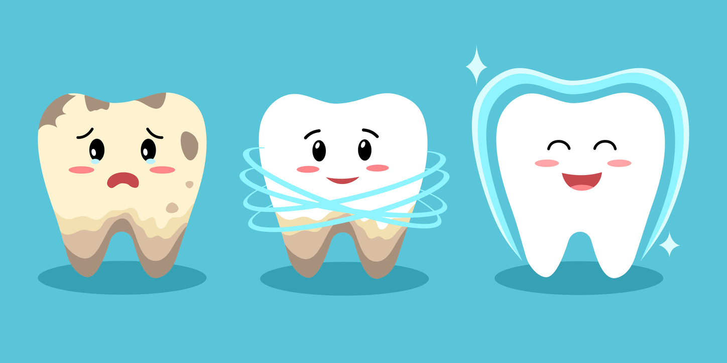 ขูดหินปูน