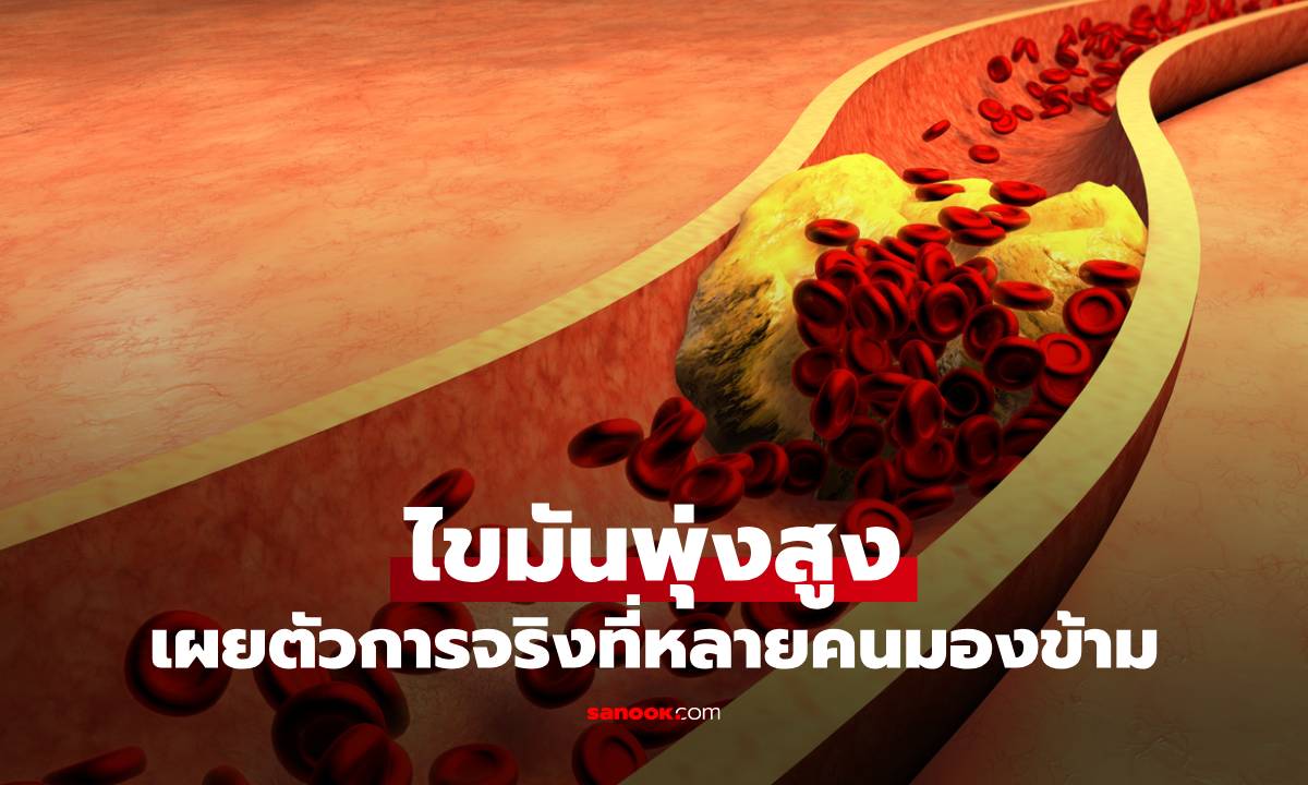 กินผักต้ม-เลี่ยงเนื้อสัตว์ทุกมื้อ แต่ไขมันพุ่ง เผยตัวการจริงที่หลายคนมองข้าม