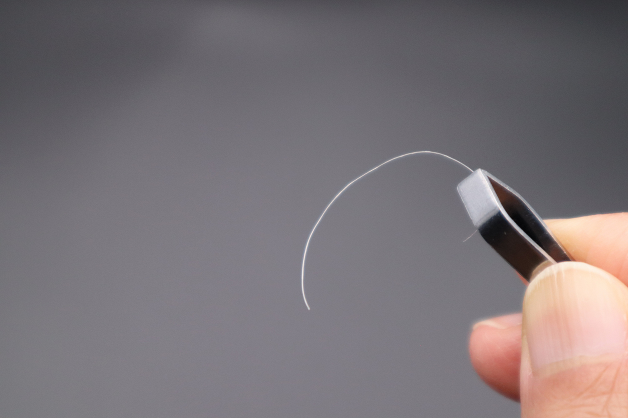 ผมหงอก เกิดจาก