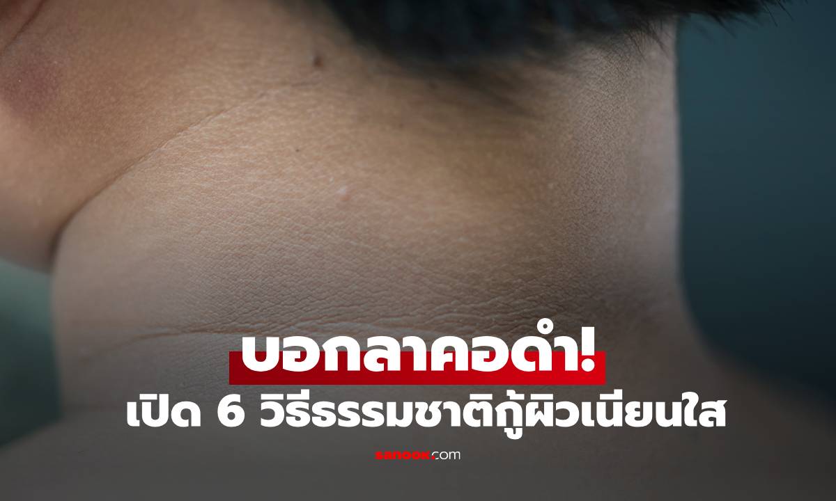 บอกลาคอดำ! เปิด 6 วิธีธรรมชาติกู้ผิวเนียนใส ให้กลับมามั่นใจได้เหมือนเดิม