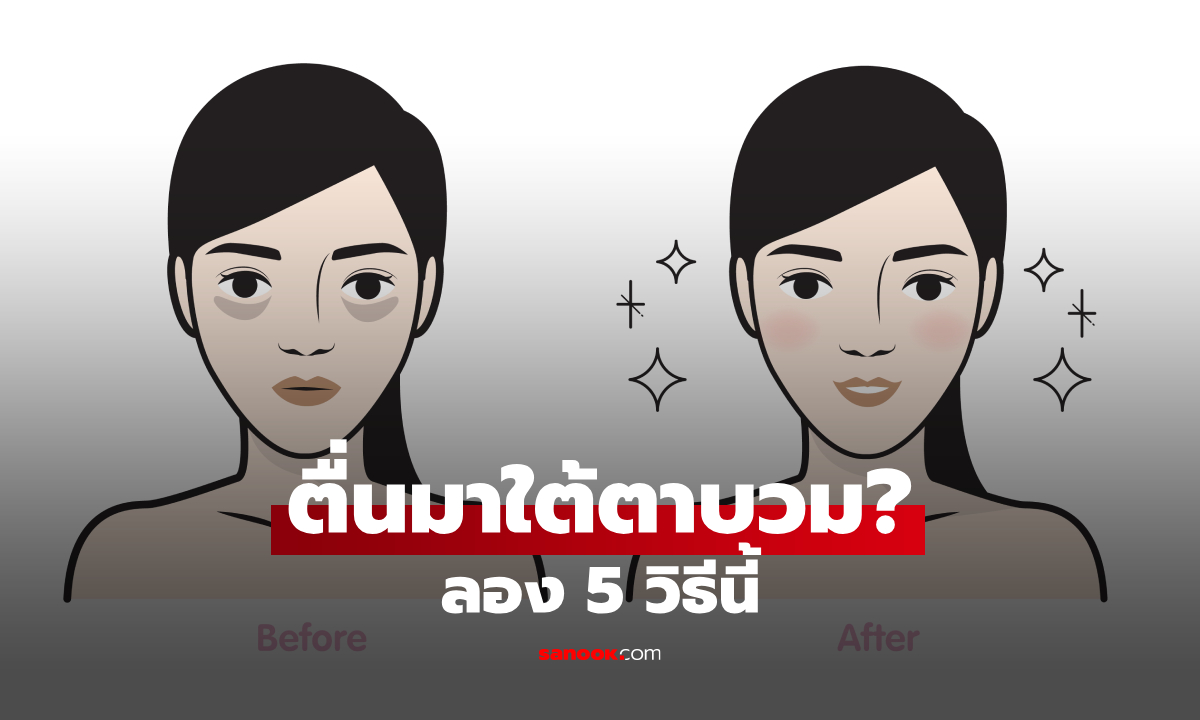 ตื่นมาใต้ตาบวมทำไงดี? 5 วิธีง่าย ๆ ช่วยให้รอบตาดูสดชื่นขึ้น