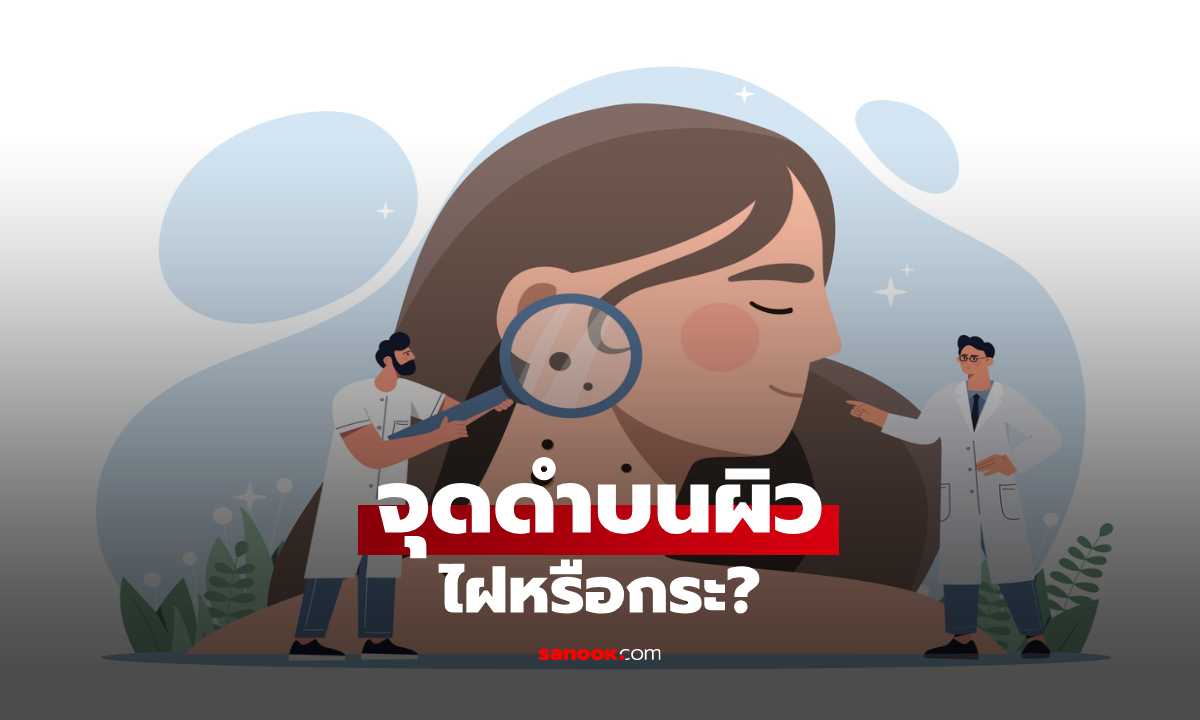 ภาพไฝกับกระ ต่างกันยังไง? เช็กง่ายๆ จากลักษณะ พร้อมสัญญาณที่ควรพบแพทย์