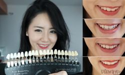 รีวิว อวดรอยยิ้มอย่างมั่นใจ! ฟันขาวโดนใจ ทำง่ายๆ ชิวเวอร์