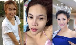 ชัดเจน! "ไดร์ จิณณ์ณิตา" Miss Thailand World 2016 หน้านี้สวยศัลยกรรม