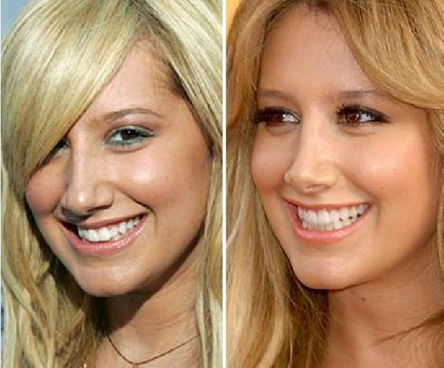 ใครบอก ดาราฮอลลีวูด สวย-หล่อ...ตั้งแต่เกิด!