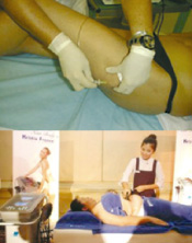 How to Lose Your Fat 5 วิธี หนีความอ้วน