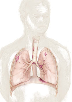 ระวัง!เครื่องพิมพ์เลเซอร์ อันตรายถึง \'ปอด\'-ทางเดินหายใจ