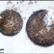 เชื้อรามรณะPseudallescheria boydii