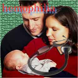 ฮีโมฟิเลีย (Hemophilia)