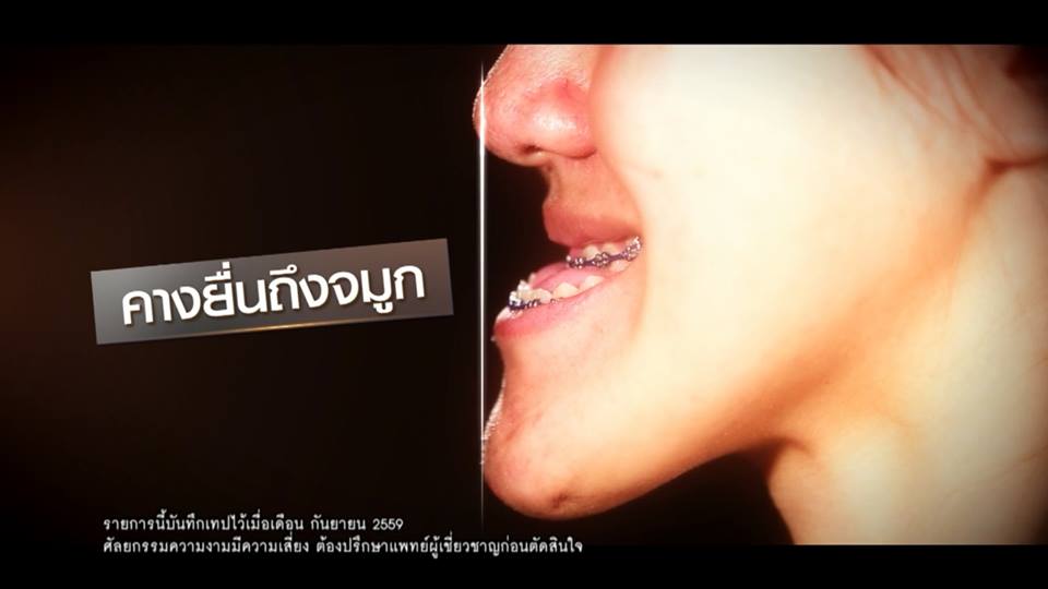 Let Me In Thailand 2