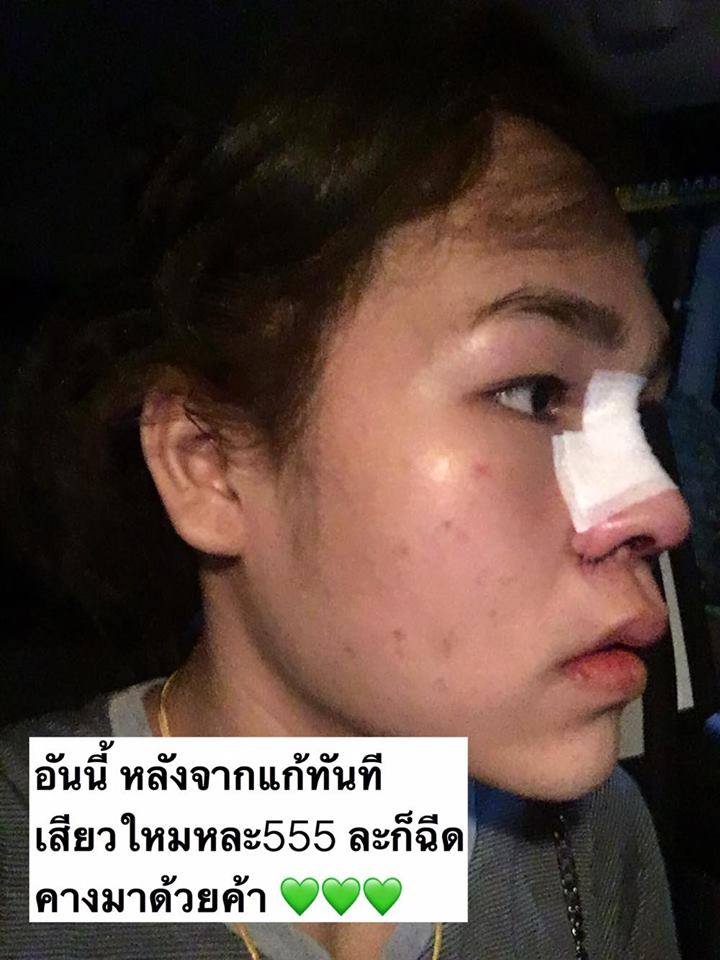 น้องปอนด์ เต้นตกเก้าอี้ 