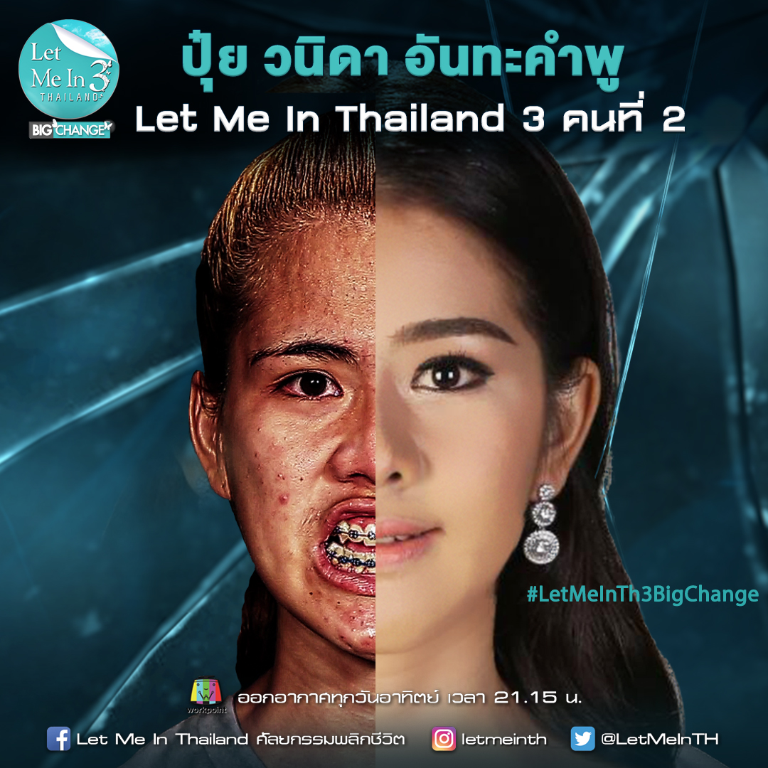 ปุ๋ย วนิดา Let Me In