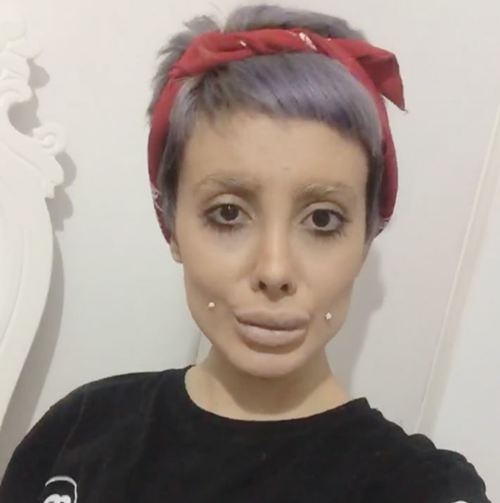 วัยรุ่นอิหร่าน วัย 19 ปี ทำศัลยกรรมกว่า 50 ครั้ง เพื่อให้หน้าเหมือนแองเจลินา โจลี