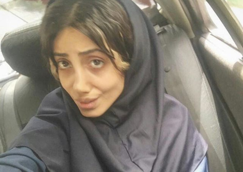 วัยรุ่นอิหร่าน วัย 19 ปี ทำศัลยกรรมกว่า 50 ครั้ง เพื่อให้หน้าเหมือนแองเจลินา โจลี