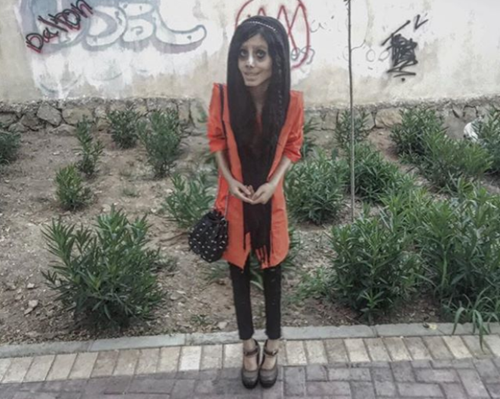 วัยรุ่นอิหร่าน วัย 19 ปี ทำศัลยกรรมกว่า 50 ครั้ง เพื่อให้หน้าเหมือนแองเจลินา โจลี